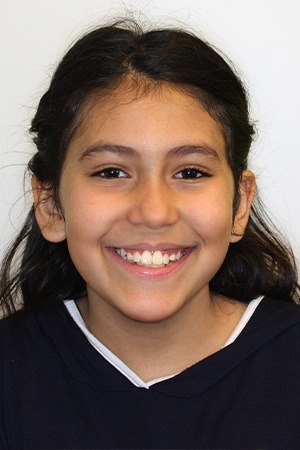 Young girl with flawless smile after orthodontics