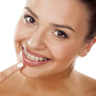 Smiling woman pointing to her braces