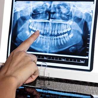 Closeup of orthodontist pointing to patient's X-ray
