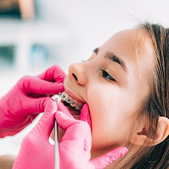 Closeup of orthodontist examining girl's braces