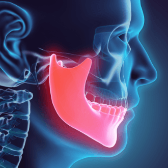 3 D rending or jaw and skull to plan dentofacial orthopedics
